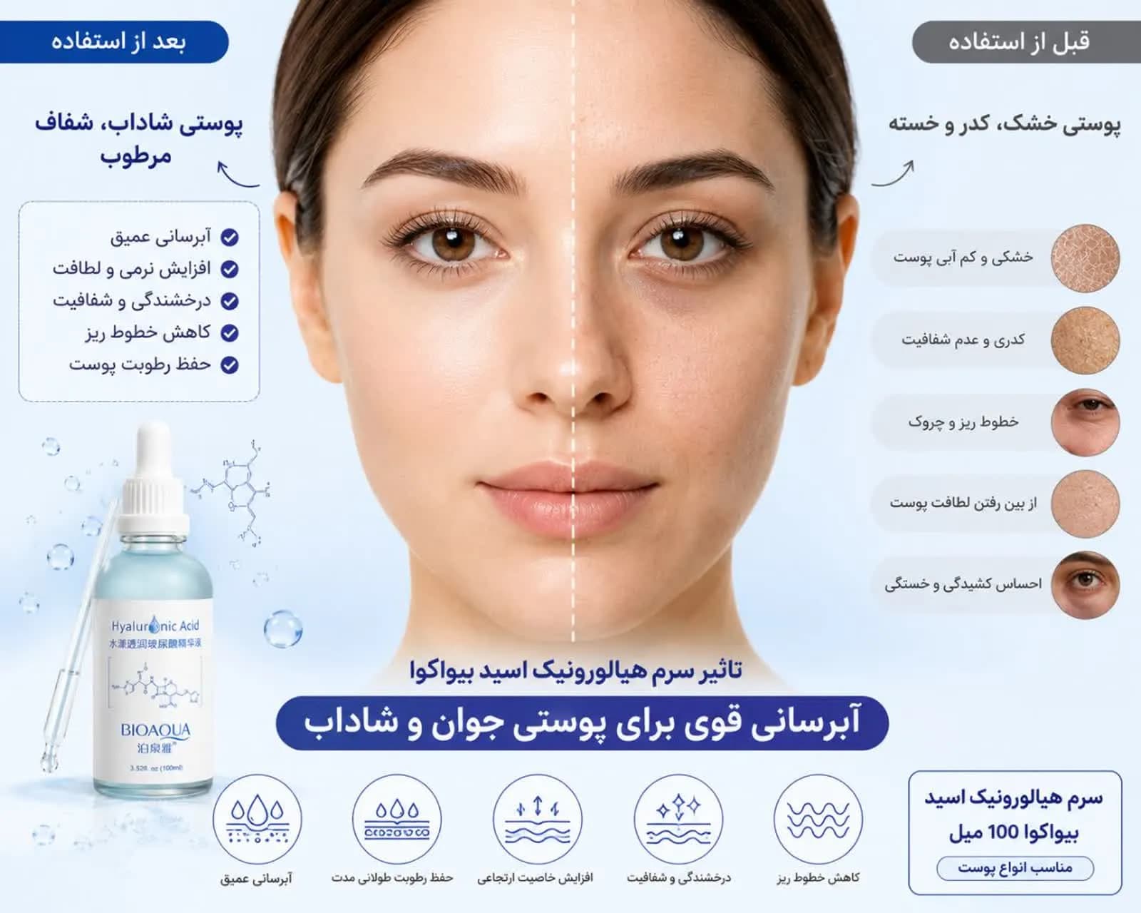 سرم هیالورونیک اسید بیواکوا 100 میل | آبرسان و مرطوب کننده قوی پوست — تصویر ۴