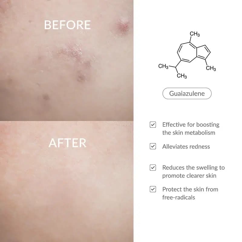 کرم ترمیم کننده و تقویت کننده سد دفاعی 147 دکتر آلتیا | Dr.Althea 147 Barrier Cream (حجم 50 میلی لیتر ) اورجینال — تصویر ۳