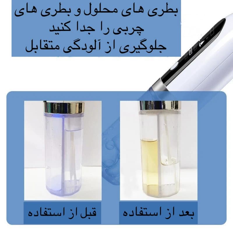 میکرودرم خانگی Super Micro Bubble | پاکسازی و جوانسازی پوست — تصویر ۸
