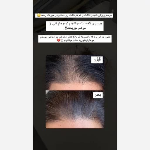 محلول رویش مجدد تقویت مو رشد موها پرتیین تقویتی ضد موخوره مخصوص همه موها و مو اسیب دیده محلول تقویت ریش — تصویر ۷