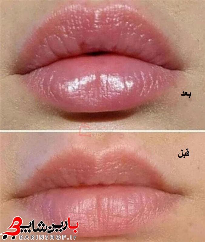 حجم دهنده لب کاریته حاوی روغن آرگان — تصویر ۵