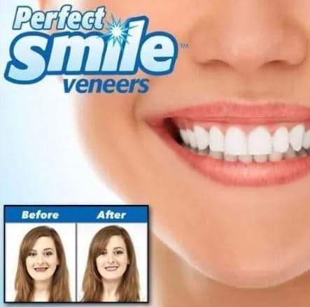 لمینت دندان پودری sowsmile دو فک — تصویر ۴