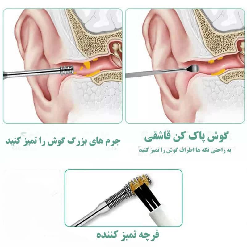 ابزار پاکسازی گوش بسته 6 عددی طلقی — تصویر ۲