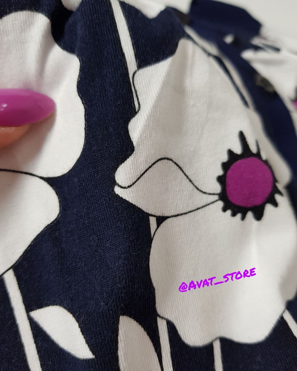 ست نارگل حلقه ای — تصویر ۵