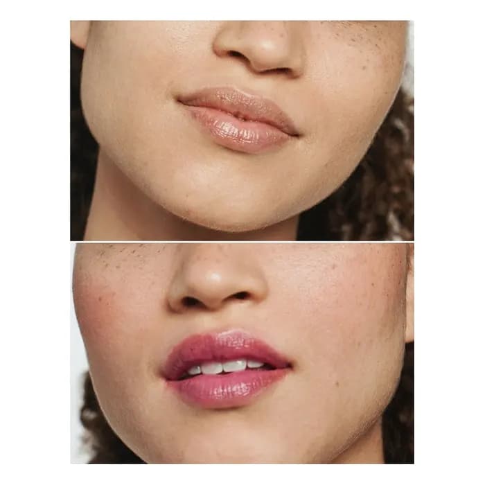 بالم لب بلک هانی دایموند کلینیک لیمیتد ادیشن — تصویر ۵
