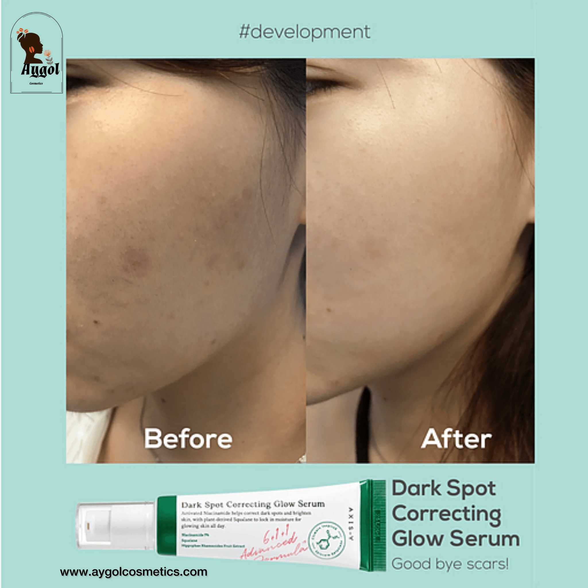 سرم ضد لک و روشن کننده حاوی نیاسینامید دارک اسپات کورکتینگ گلو اکسیس وای AXIS-Y Dark Spot Correcting Glow Serum — تصویر ۵