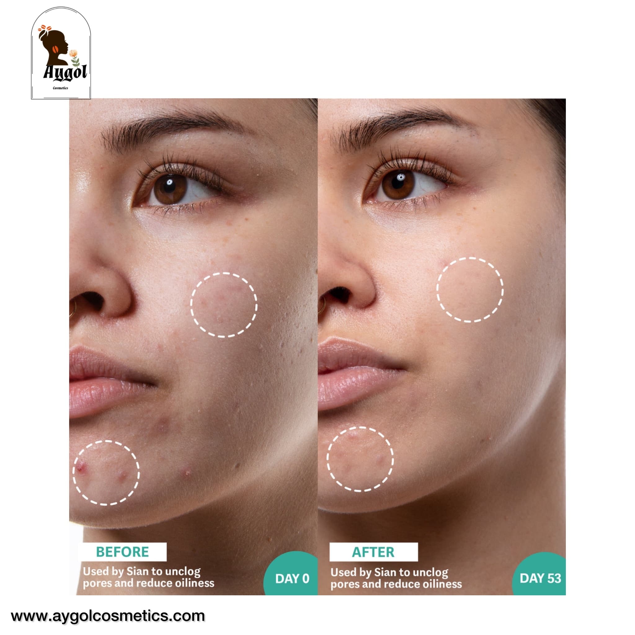 سرم ضد جوش و کنترل چربی حاوی اسید سالیسیلیک و کلپ دریایی سلفلس بای هیرام Selfless by Hyram Salicylic Acid & Sea Kelp Pore Clearing and Oil Control Serum — تصویر ۷
