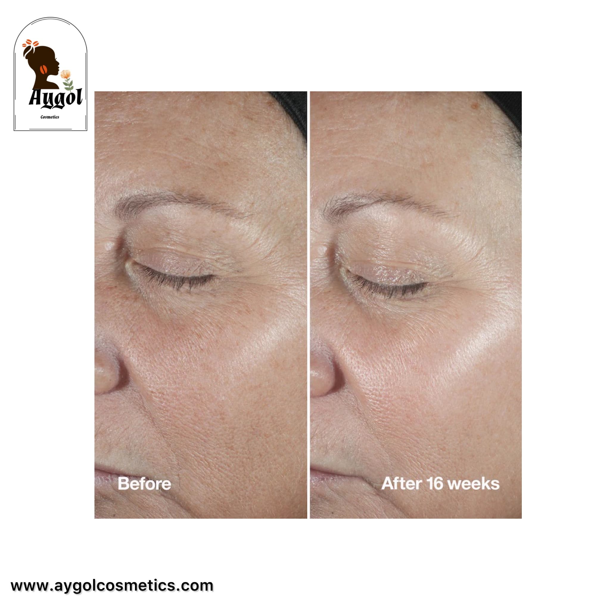 سرم روشن کننده و پیشگیری از لکه های تیره ایون بتر کلینیکال کلینیک حجم 30ML Clinique Even Better Clinical Radical Dark Spot Corrector + Interrupter — تصویر ۶