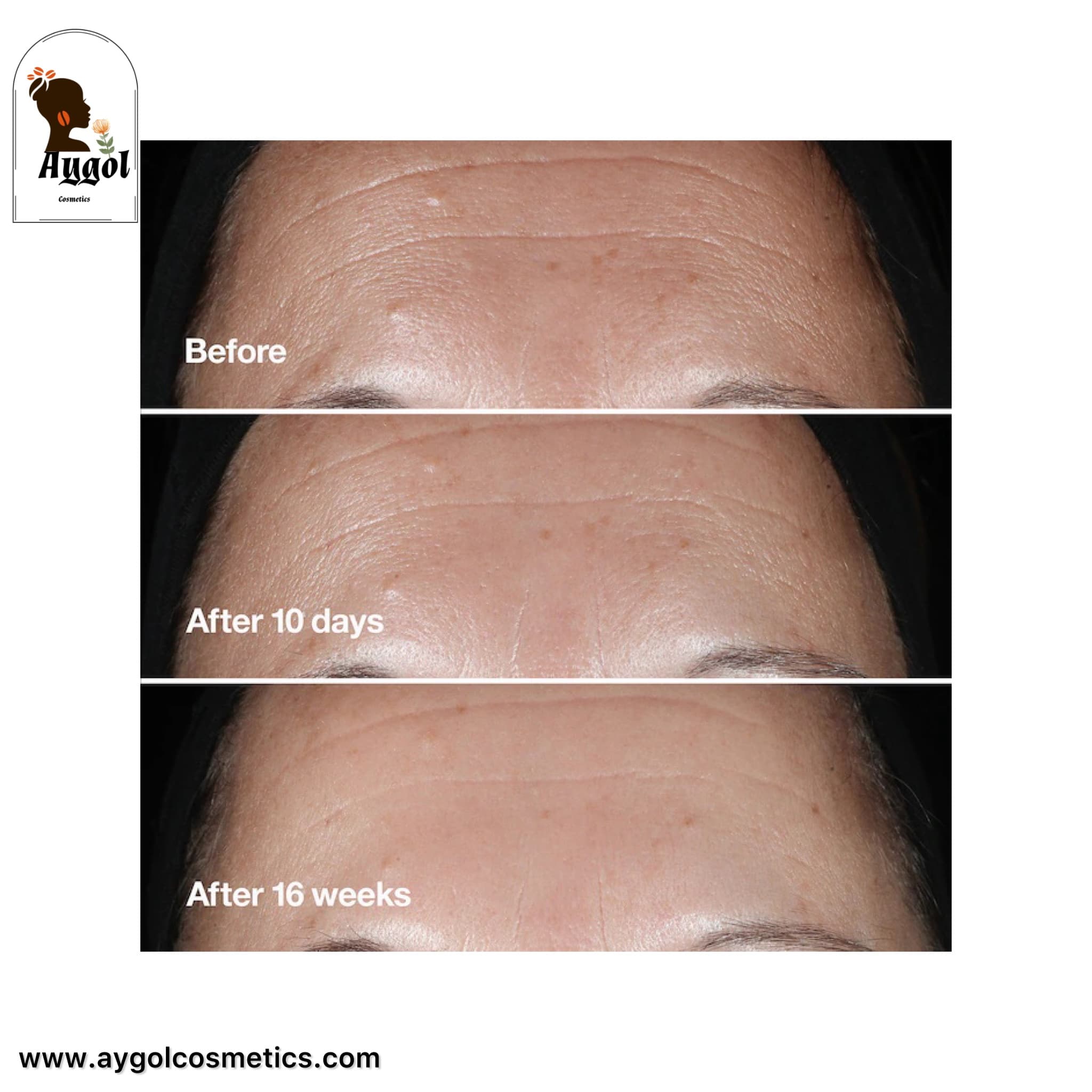 سرم روشن کننده و پیشگیری از لکه های تیره ایون بتر کلینیکال کلینیک حجم 30ML Clinique Even Better Clinical Radical Dark Spot Corrector + Interrupter — تصویر ۵
