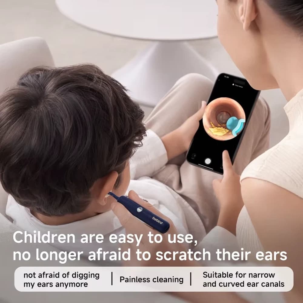 تمیز کننده گوش دوربین دار شیائومی مدل Bebird Earsight plus I35R — تصویر ۵