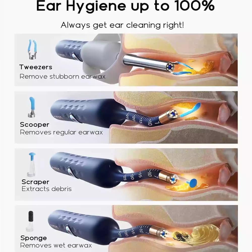 تمیز کننده گوش دوربین دار شیائومی مدل Bebird Smart Visual Ear Cleaner R37R — تصویر ۲