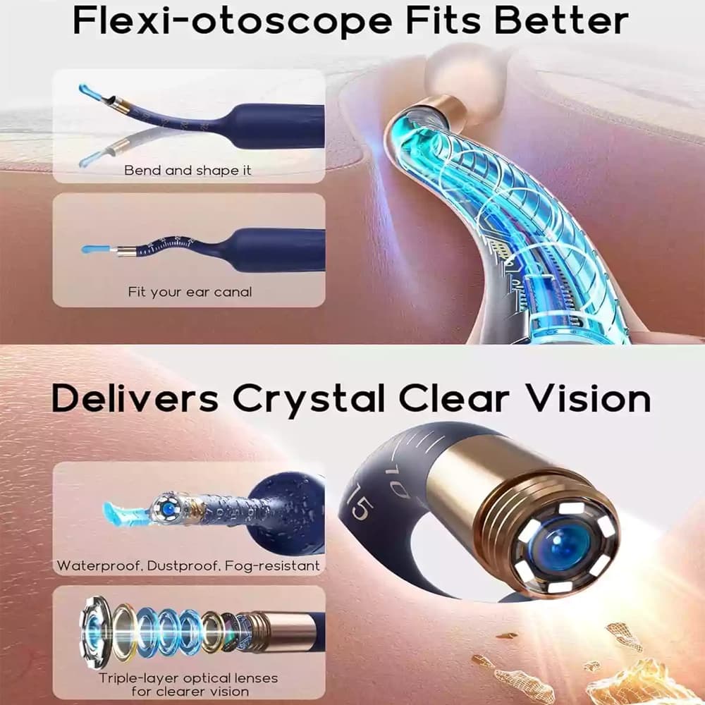 تمیز کننده گوش دوربین دار شیائومی مدل Bebird Smart Visual Ear Cleaner R37R — تصویر ۴