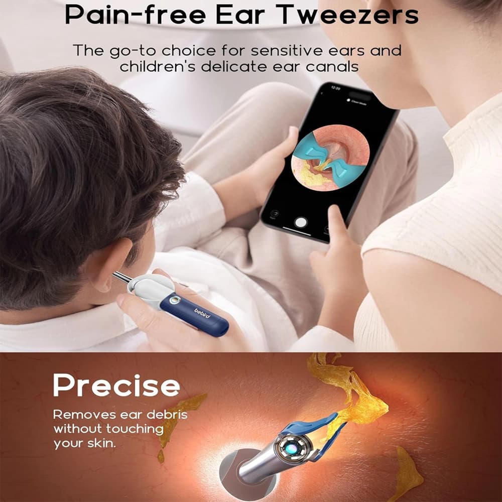 تمیز کننده گوش دوربین دار شیائومی مدل Bebird Smart Visual Ear Cleaner R37R — تصویر ۳