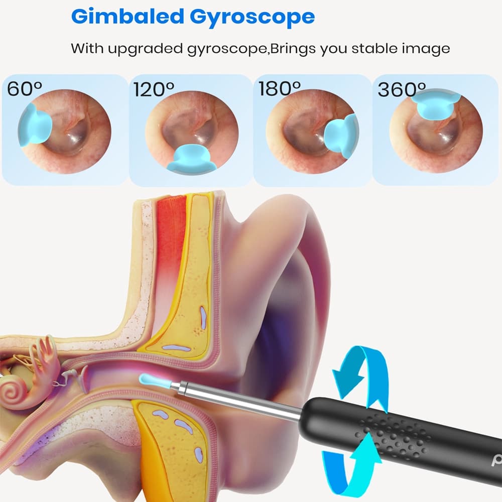 گوش پاک کن هوشمند شیائومی مدل Bebird Smart Visual Ear Cleaning R1 — تصویر ۴