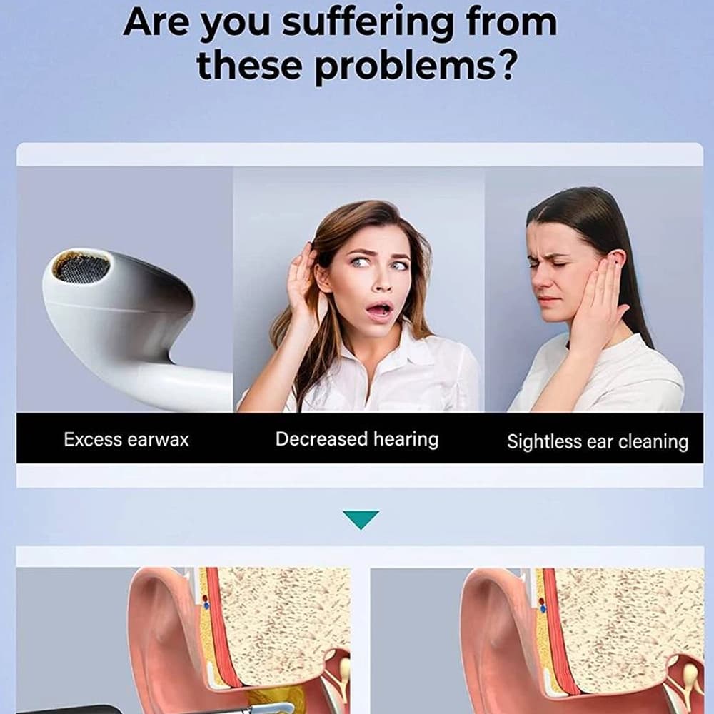 گوش پاک کن هوشمند شیائومی مدل Bebird Smart Visual Ear Cleaning R1 — تصویر ۵