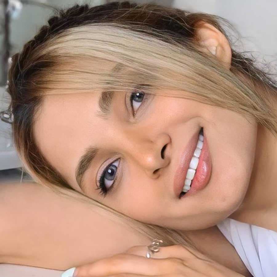 لنز طبی رنگی شیخ میستی گری فصلی — تصویر ۶