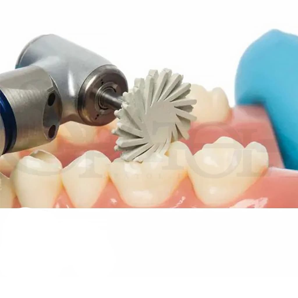 دیسک خورشیدی کامپوزیت Jiffy Natural composite system spiral wheel Medium برند الترادنت Ultradent — تصویر ۳