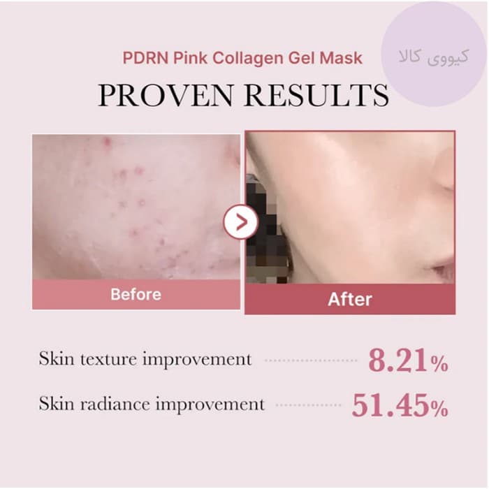 ماسک ژلی کلاژن مدی کیوب Medicube مدل PDRN Pink — تصویر ۵