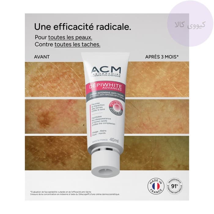 کرم ضد لک اسی سی ام ACM اصل دپی وایت depiwhite — تصویر ۳