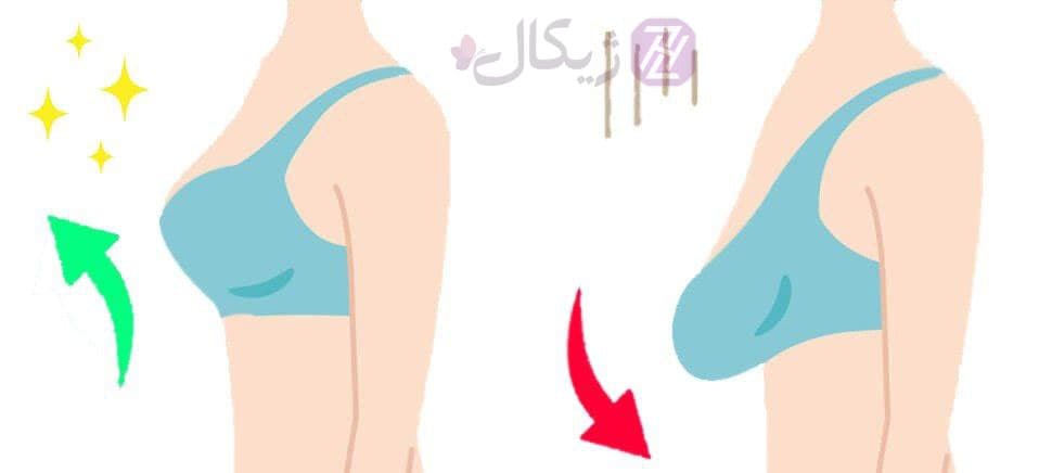سوتین لیفتینگ و بالا برنده سینه — تصویر ۷