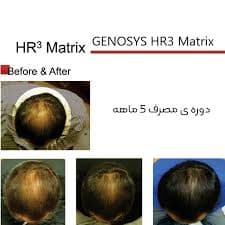کوکتل تقویت و ضد ریزش مو HR3 ژنوسیس — تصویر ۲