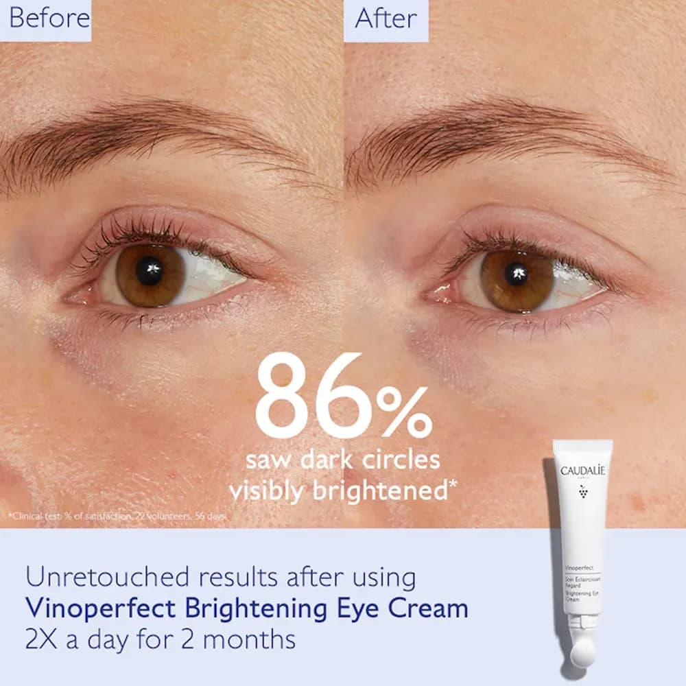 کرم دور چشم کدلی Vinoperfect — تصویر ۲