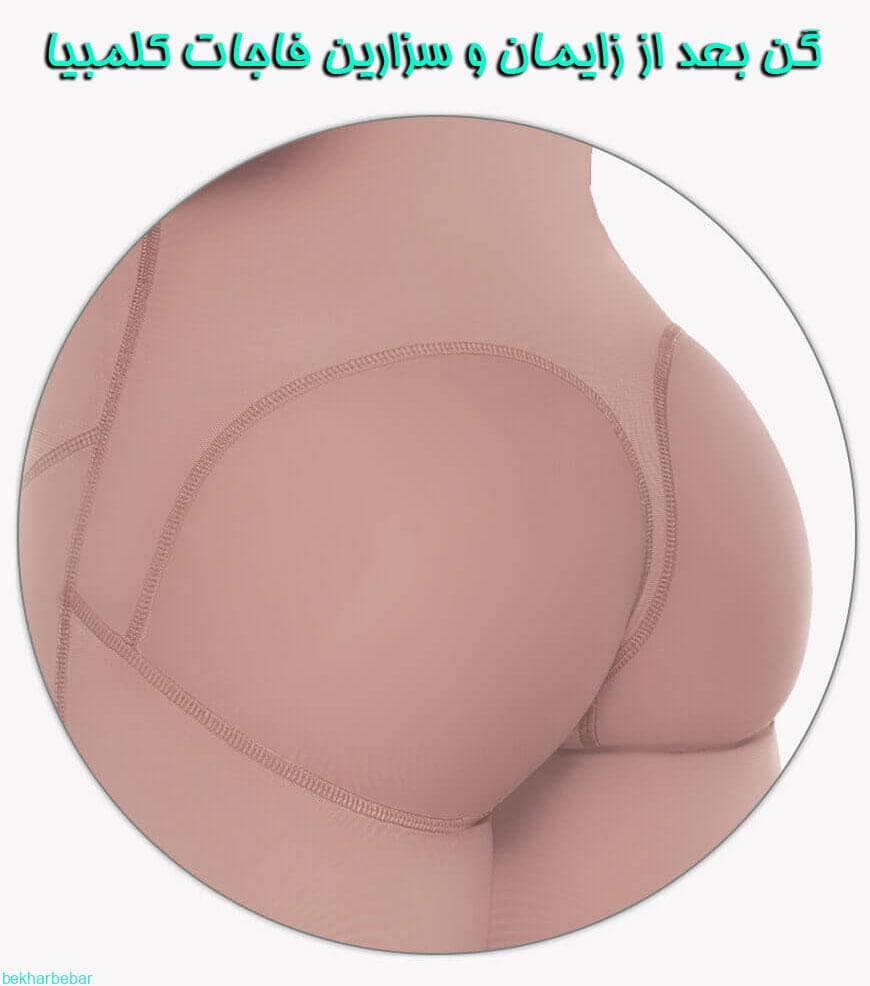 گن سزارین بهترین گن بعد از زایمان برای لاغری شکم و پهلو — تصویر ۵