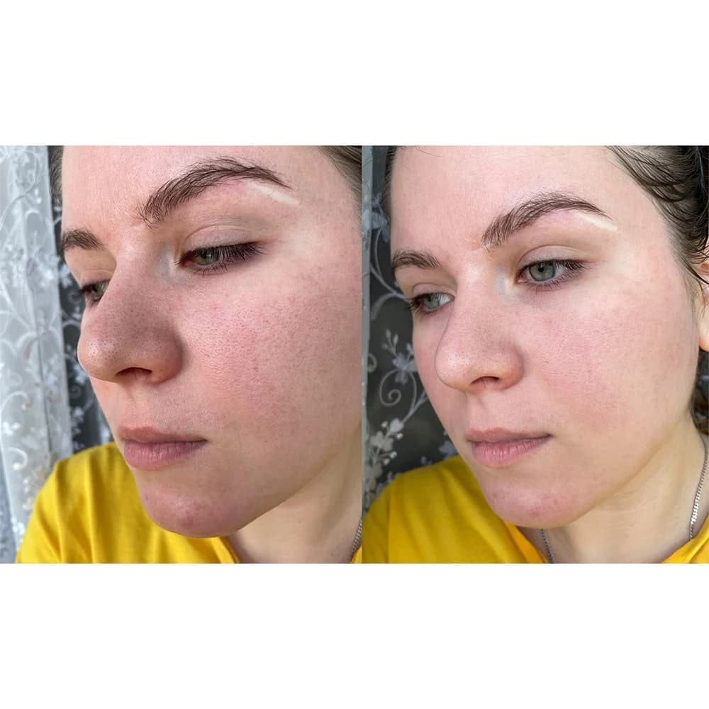 ماسک صورت ماگورت اکسیس وای پاک کننده منافذ باز حجم 100 میلی لیتر — تصویر ۴