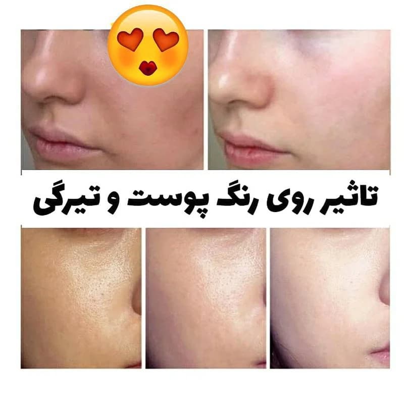 آمپول روشن کننده و ضد چروک حاوی ویتامین Dr V8 فارم استی حجم 250 میلی لیتر — تصویر ۲