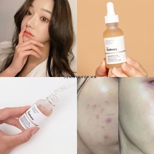 سرم لاکتیک اسید 10 درصد اوردینری 30 میل ( لایه بردار و شفاف کننده ) — تصویر ۴