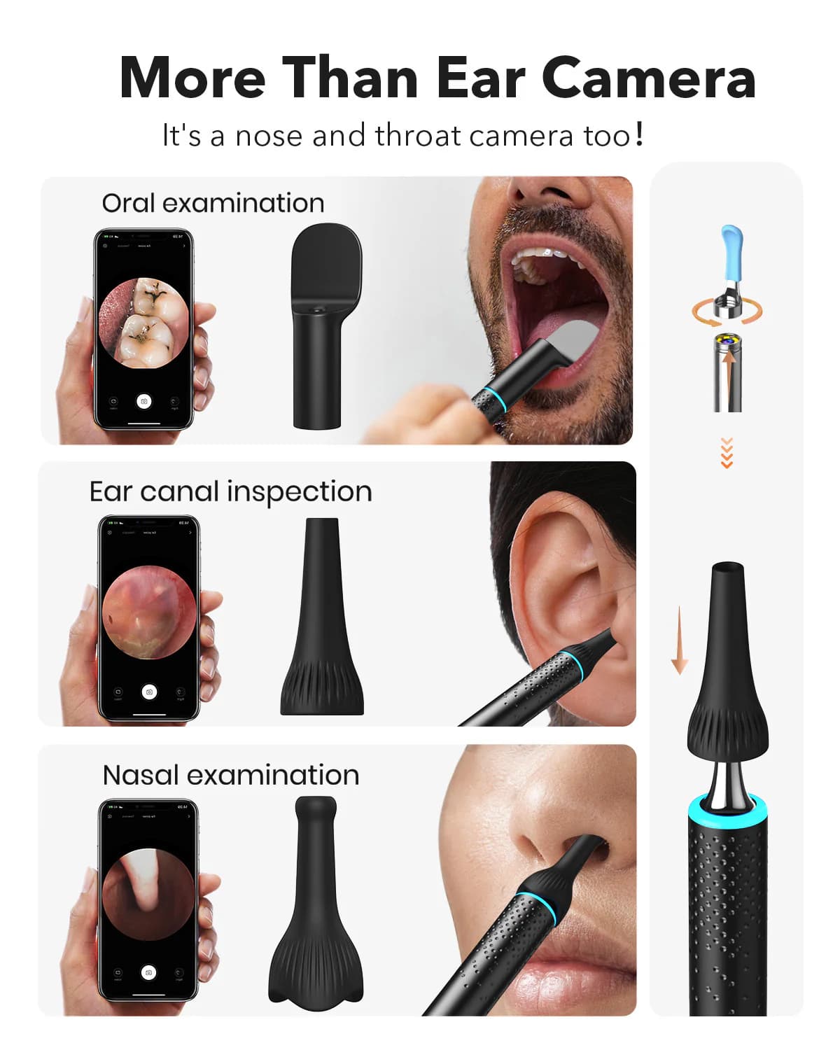 گوش پاک کن هوشمند Bebird EarSight Cleaner — تصویر ۵
