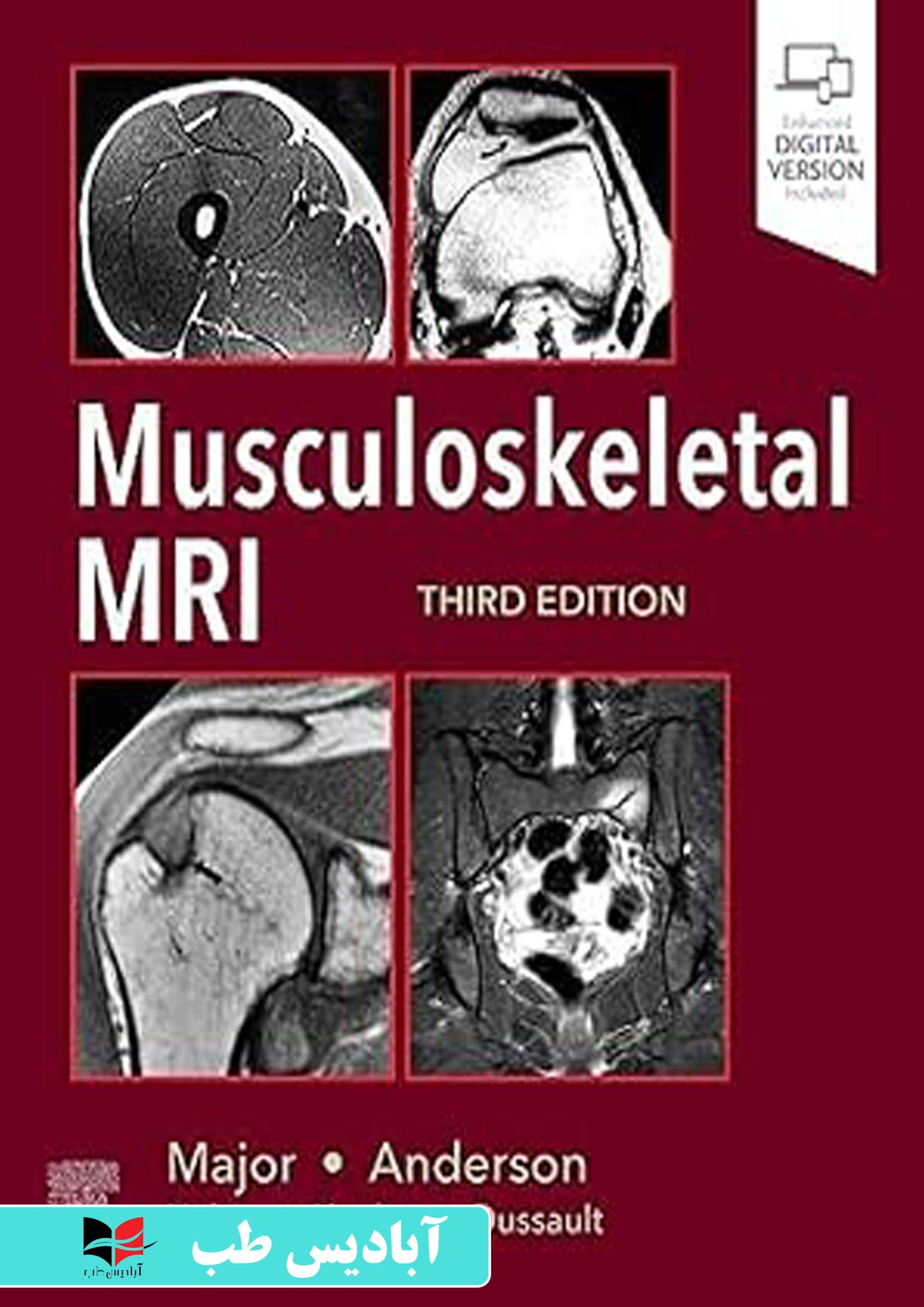 Musculoskeletal MRI 3rd Edition | اسکلتی عضلانی ویرایش سوم MRI