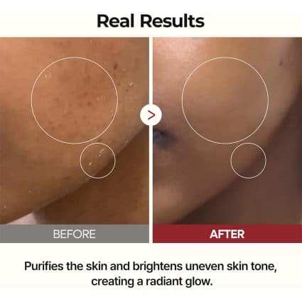 تونر پیل شات برنج دکتر ملاکسین Dr. Melaxin (لایه بردار و روشن کننده پوست) اورجینال — تصویر ۷