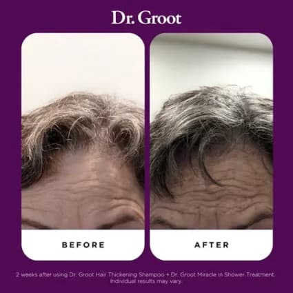 سرم ضد ریزش دکتر گروت Dr.Groot (ضخیم‌کننده قوی مو) اورجینال — تصویر ۹