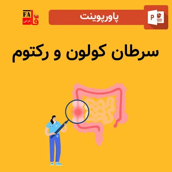 پاورپوینت سرطان کولون و رکتوم