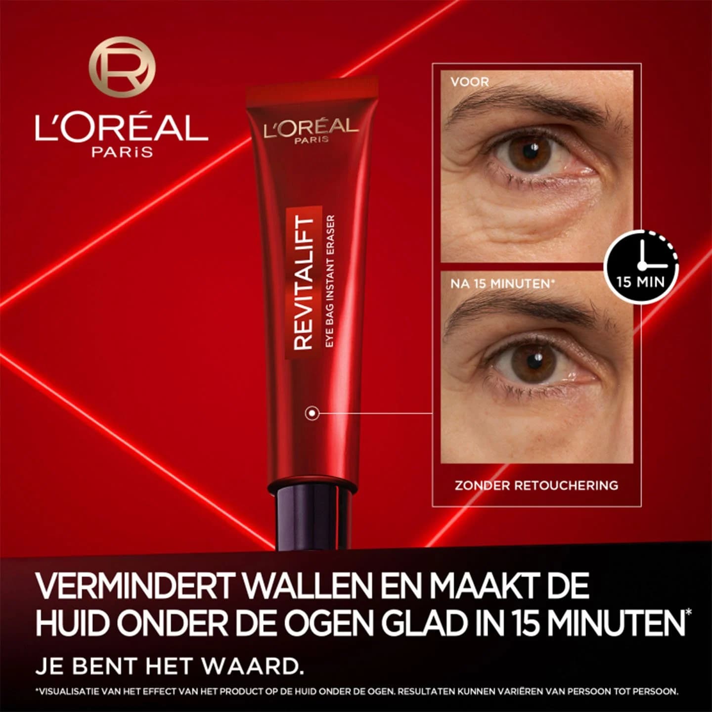کرم پف و کیسه دور چشم رویتالیفت لیزر لورال 15ml — تصویر ۷