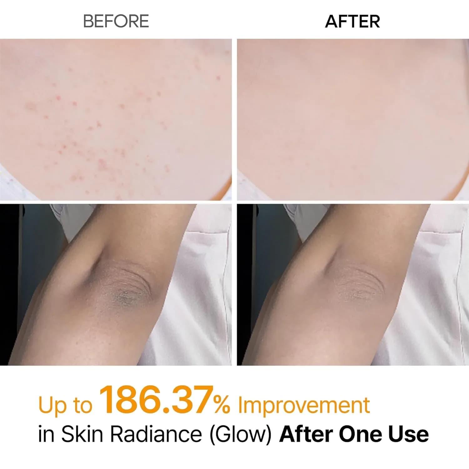 اسپری لایه‌بردار بدن دکتر ملاکسین مدل Body Keratin Care حجم 200 میل — تصویر ۴