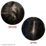 سرم ضد ریزش و تقویت رشد موی هیرتامین Hairtamin Scalp Serum اصل امریکا — تصویر ۶