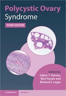 کتاب Polycystic Ovary Syndrome