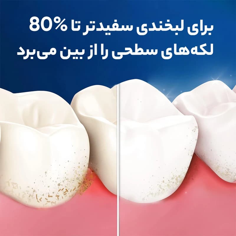 مسواک اورال-بی مدل 3D White — تصویر ۶