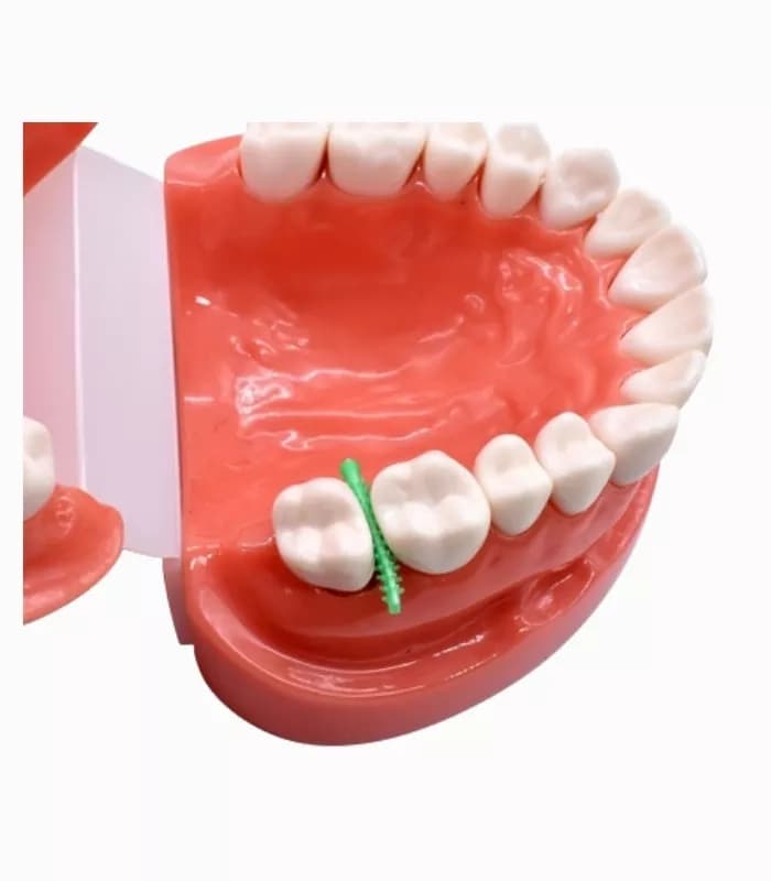 وج کاجی – Zt Dental Adaptive Wedges — تصویر ۶