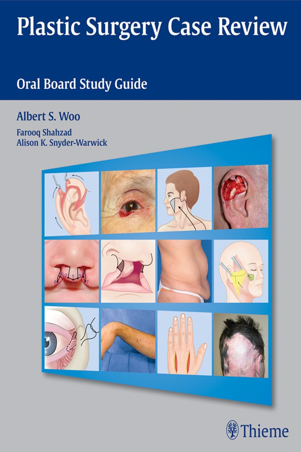 مرور موارد جراحی پلاستیک ۲۰۱۴ <br> Plastic Surgery Case Review 2014