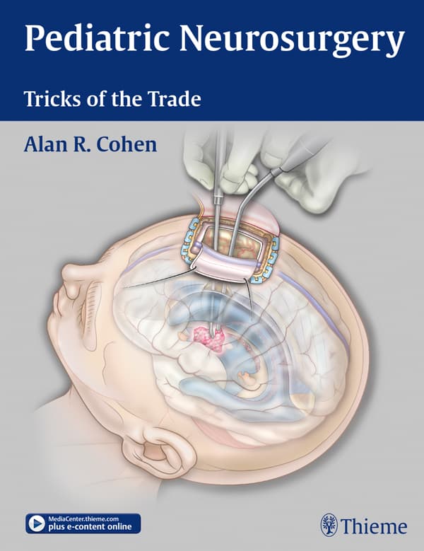 جراحی مغز و اعصاب کودکان: ترفندهای این حرفه ۲۰۱۵ <br> Pediatric Neurosurgery: Tricks of the Trade 2015 — تصویر ۲
