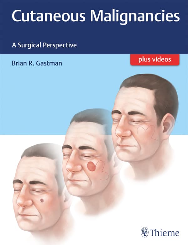 بدخیمیهای پوستی ۲۰۱۶ <br> Cutaneous Malignancies 2016