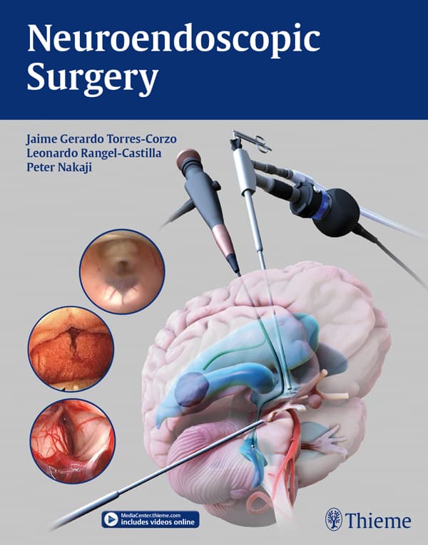 جراحی نورواندوسکوپی ۲۰۱۹ <br> Neuroendoscopic Surgery 2019