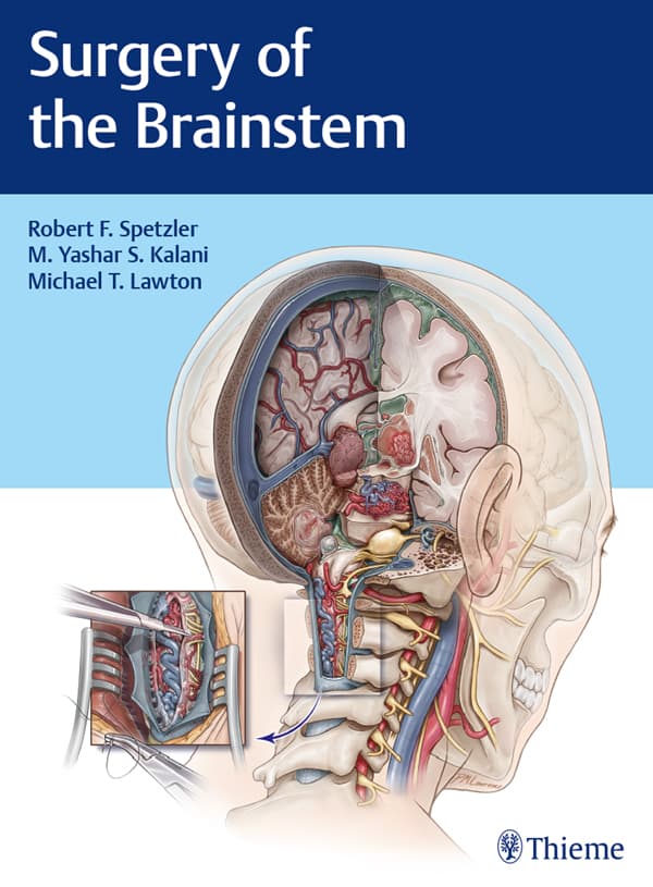 جراحی ساقه مغز ۲۰۱۹ <br> Surgery of the Brainstem 2019 — تصویر ۲