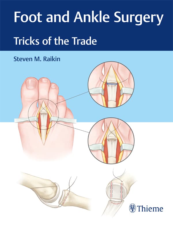 جراحی پا و مچ پا ۲۰۱۸ <br> Foot and Ankle Surgery 2018