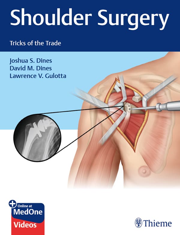 جراحی شانه ۲۰۱۹ <br> Shoulder Surgery 2019