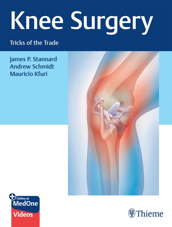 جراحی زانو ۲۰۲۲ <br> Knee Surgery 2022