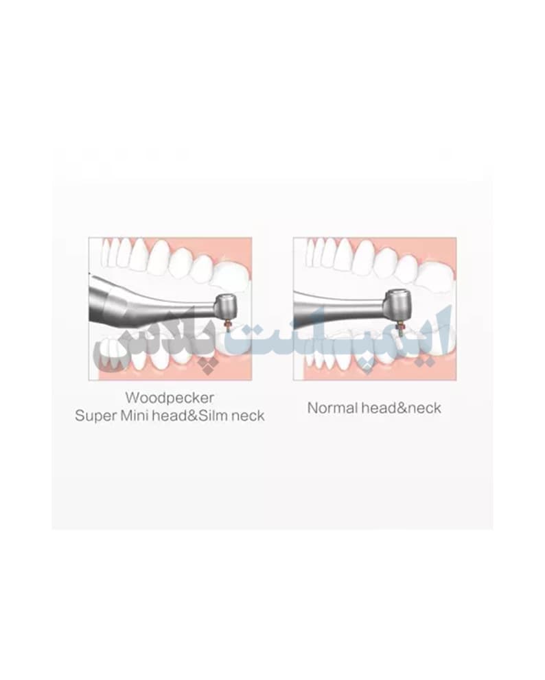 موتور اندو بی سیم Woodpecker – Ai-Motor — تصویر ۹